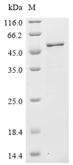 (Tris-Glycine gel) Discontinuous SDS-PAGE (reduced) with 5% enrichment gel and 15% separation gel.