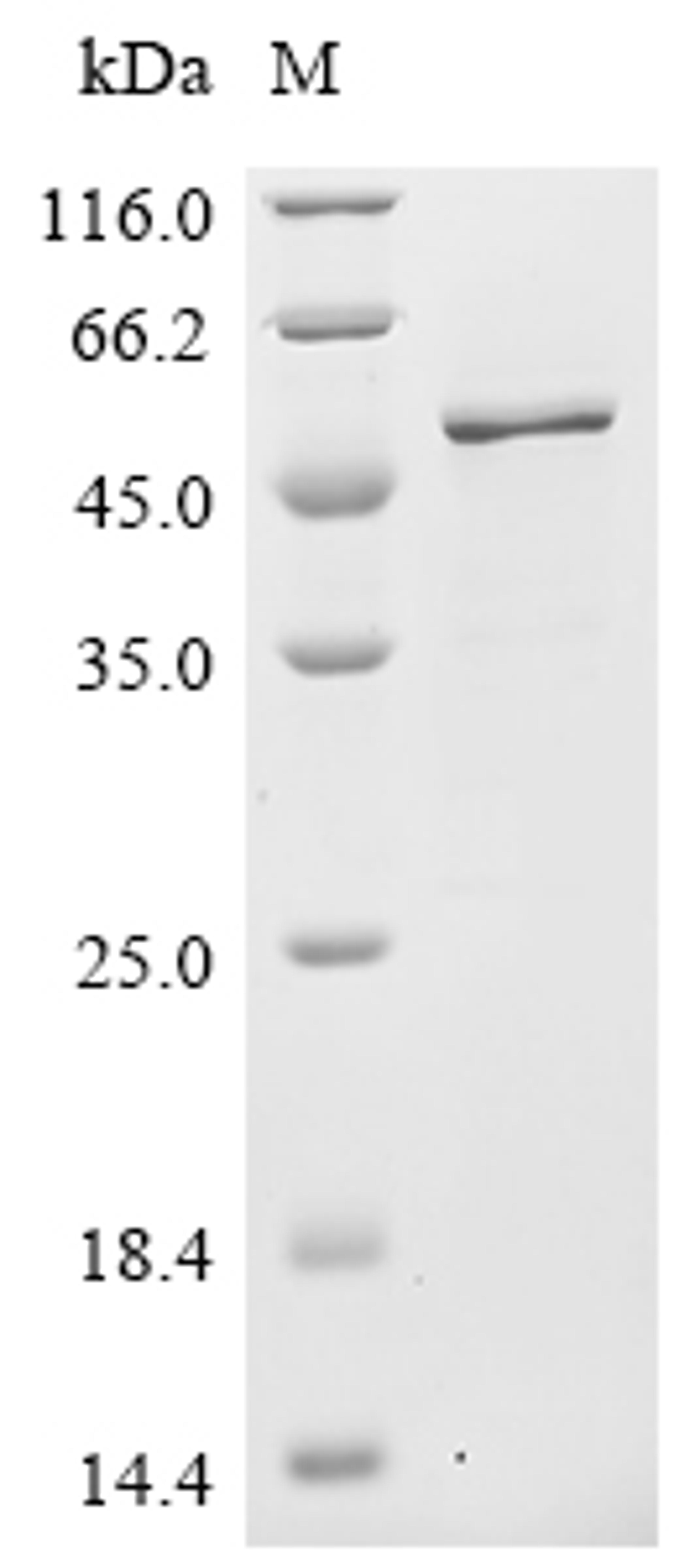 (Tris-Glycine gel) Discontinuous SDS-PAGE (reduced) with 5% enrichment gel and 15% separation gel.