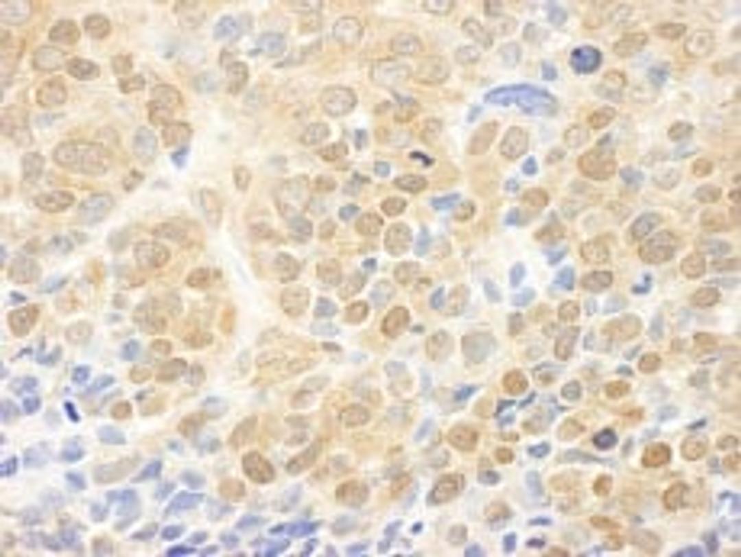 Detection of human MEK1 by immunohistochemistry.