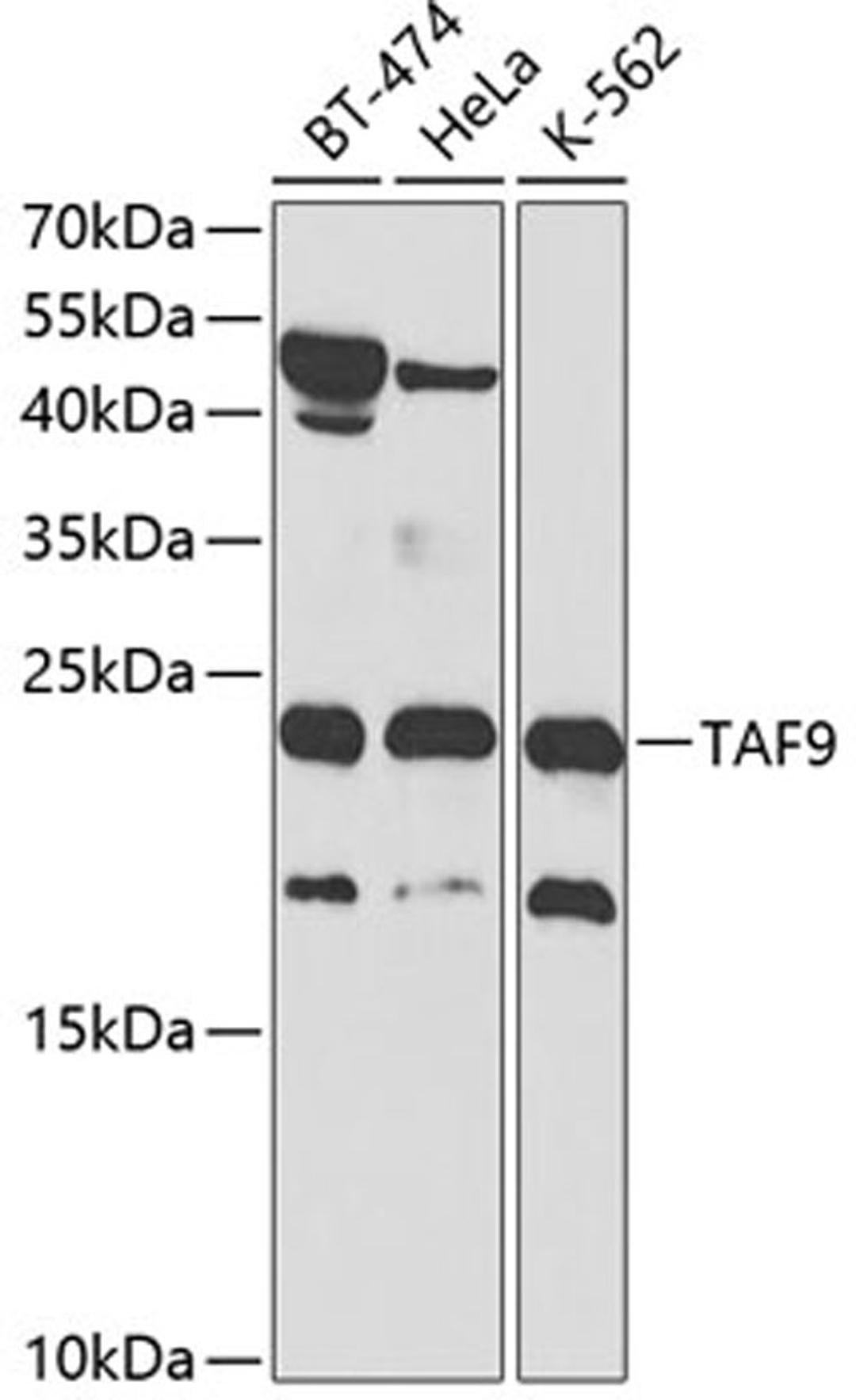 Western blot - TAF9 antibody (A2021)