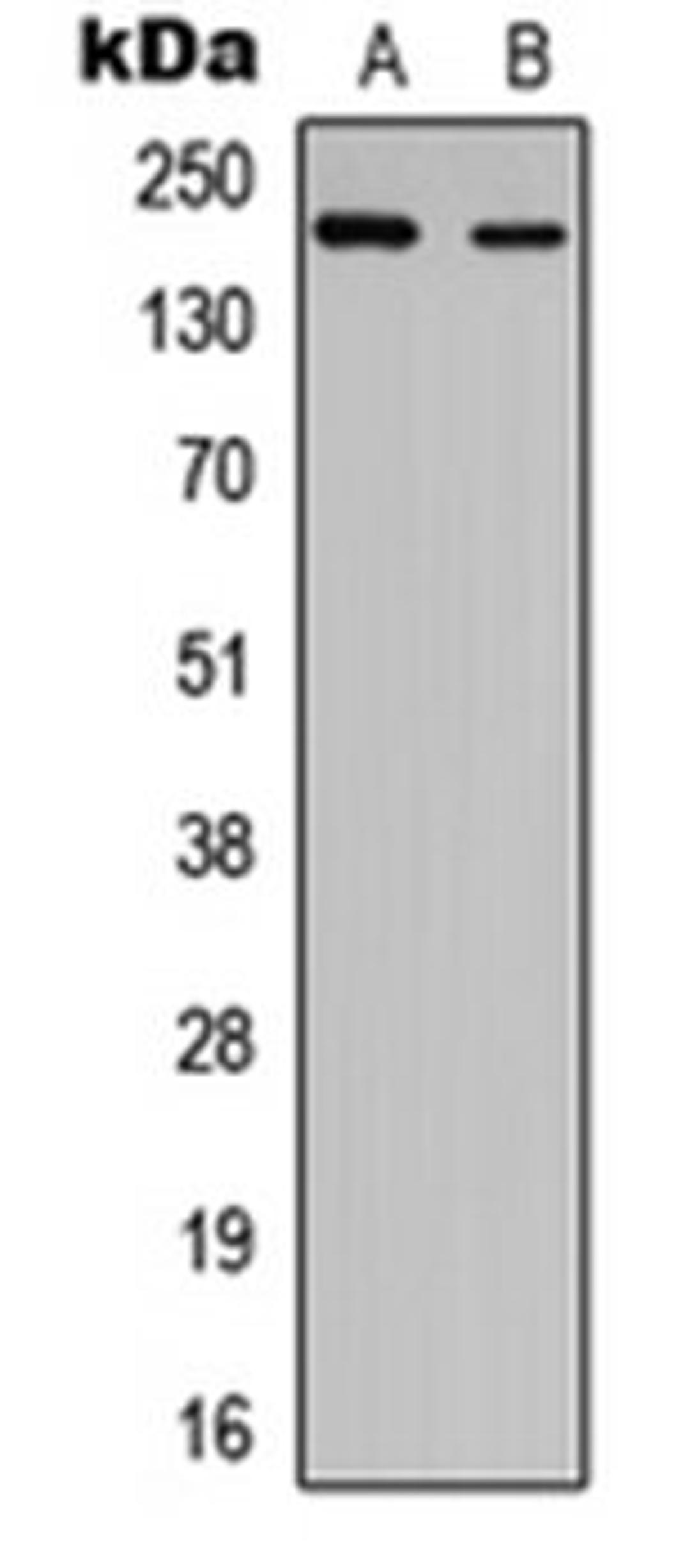 Western blot analysis of HEK293T (Lane 1), PC12 (Lane 2) whole cell lysates using NUP210L antibody