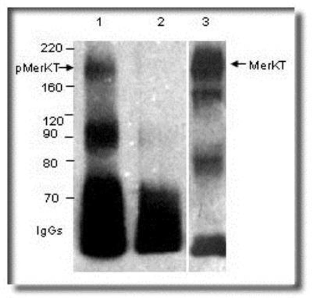 Western Blot: Mer [p Tyr749, p Tyr753] Antibody [NB300-690] - Phospho & non-Phospho-MerTK with Phospho-MERTK Antibody (NB300-690). Phosphorylated (1) & un-phosphorylated (2, 3) MERTK was immunoprecipitated with MERTK and blotted with Phospho-MerTK antibody (NB300-690). MW of MERTK is 174 kDa. Lower broad band is of IgGs in the immunoprecipitates.