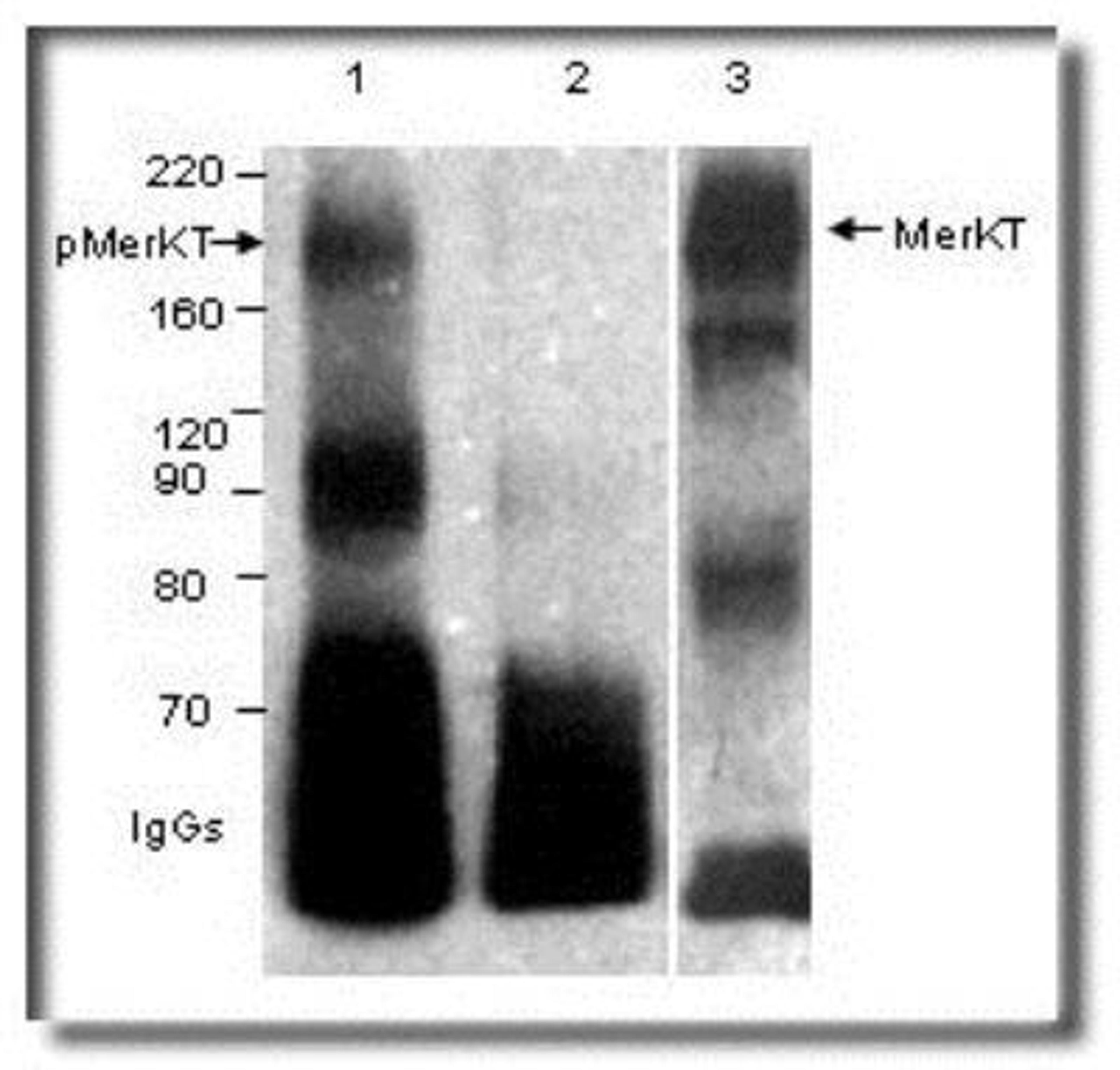 Western Blot: Mer [p Tyr749, p Tyr753] Antibody [NB300-690] - Phospho & non-Phospho-MerTK with Phospho-MERTK Antibody (NB300-690). Phosphorylated (1) & un-phosphorylated (2, 3) MERTK was immunoprecipitated with MERTK and blotted with Phospho-MerTK antibody (NB300-690). MW of MERTK is 174 kDa. Lower broad band is of IgGs in the immunoprecipitates.