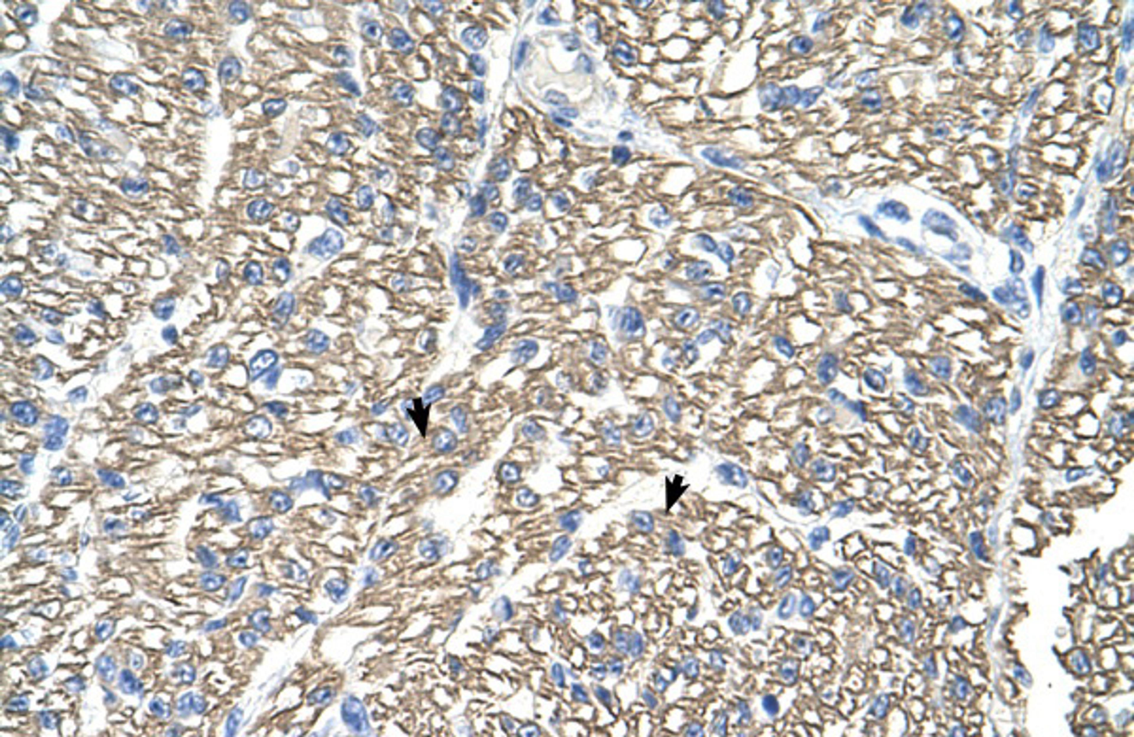 Antibody used in IHC on Human Heart.