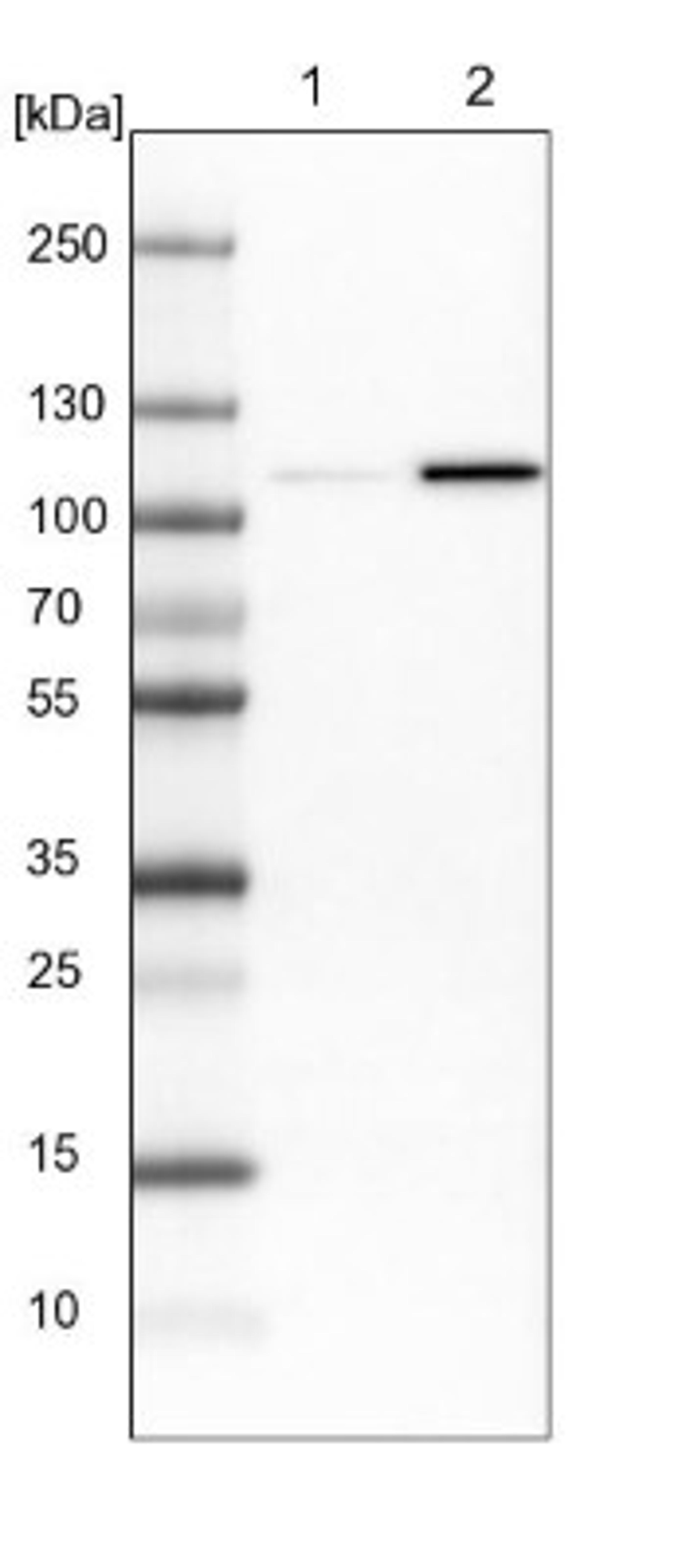 Western Blot: ENPP-3/CD203c Antibody [NBP1-88928] - Lane 1: NIH-3T3 cell lysate (Mouse embryonic fibroblast cells)<br/>Lane 2: NBT-II cell lysate (Rat Wistar bladder tumour cells)