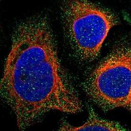 Immunocytochemistry/Immunofluorescence: SCIN Antibody [NBP1-89230] - Staining of human cell line U-2 OS shows positivity in cytoplasm.