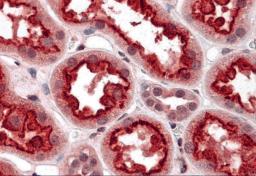 Immunohistochemistry of TAB3 in human kidney tissue with TAB3 antibody at 5 &#956;g/mL.