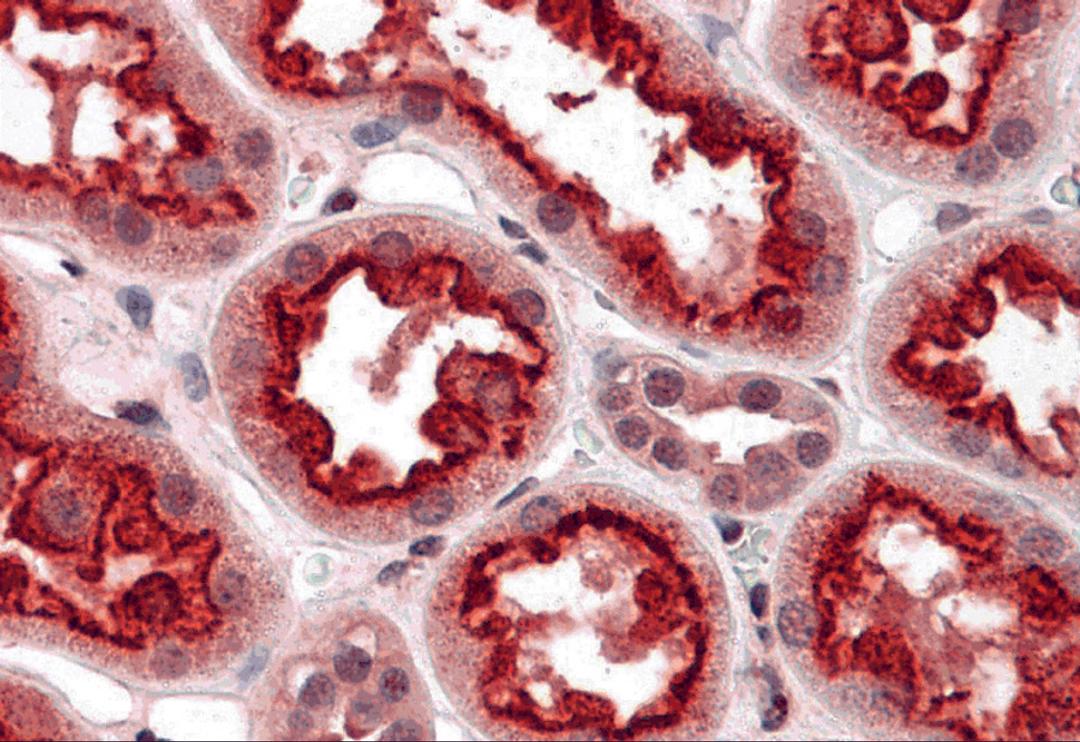 Immunohistochemistry of TAB3 in human kidney tissue with TAB3 antibody at 5 μg/mL.