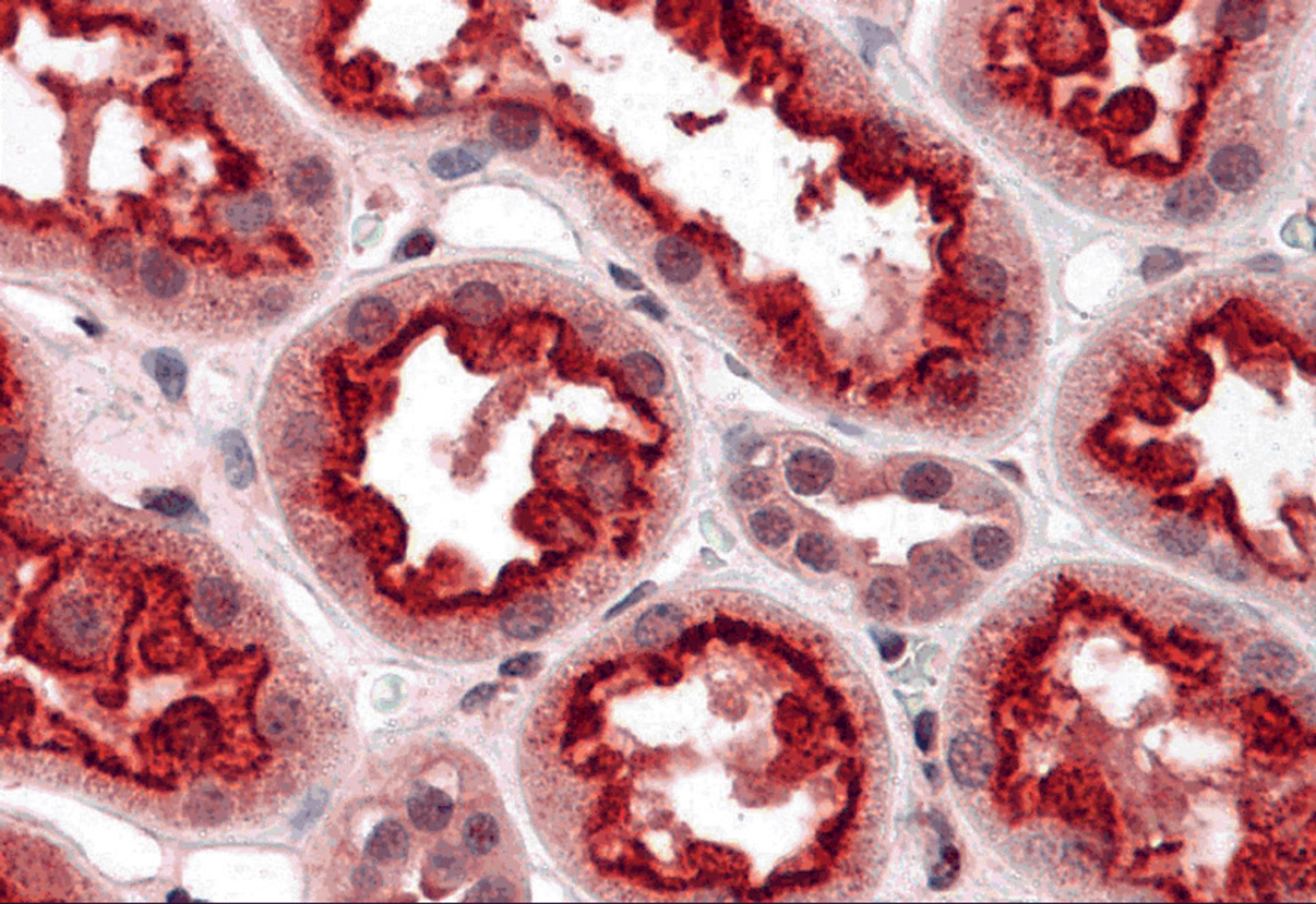 Immunohistochemistry of TAB3 in human kidney tissue with TAB3 antibody at 5 μg/mL.