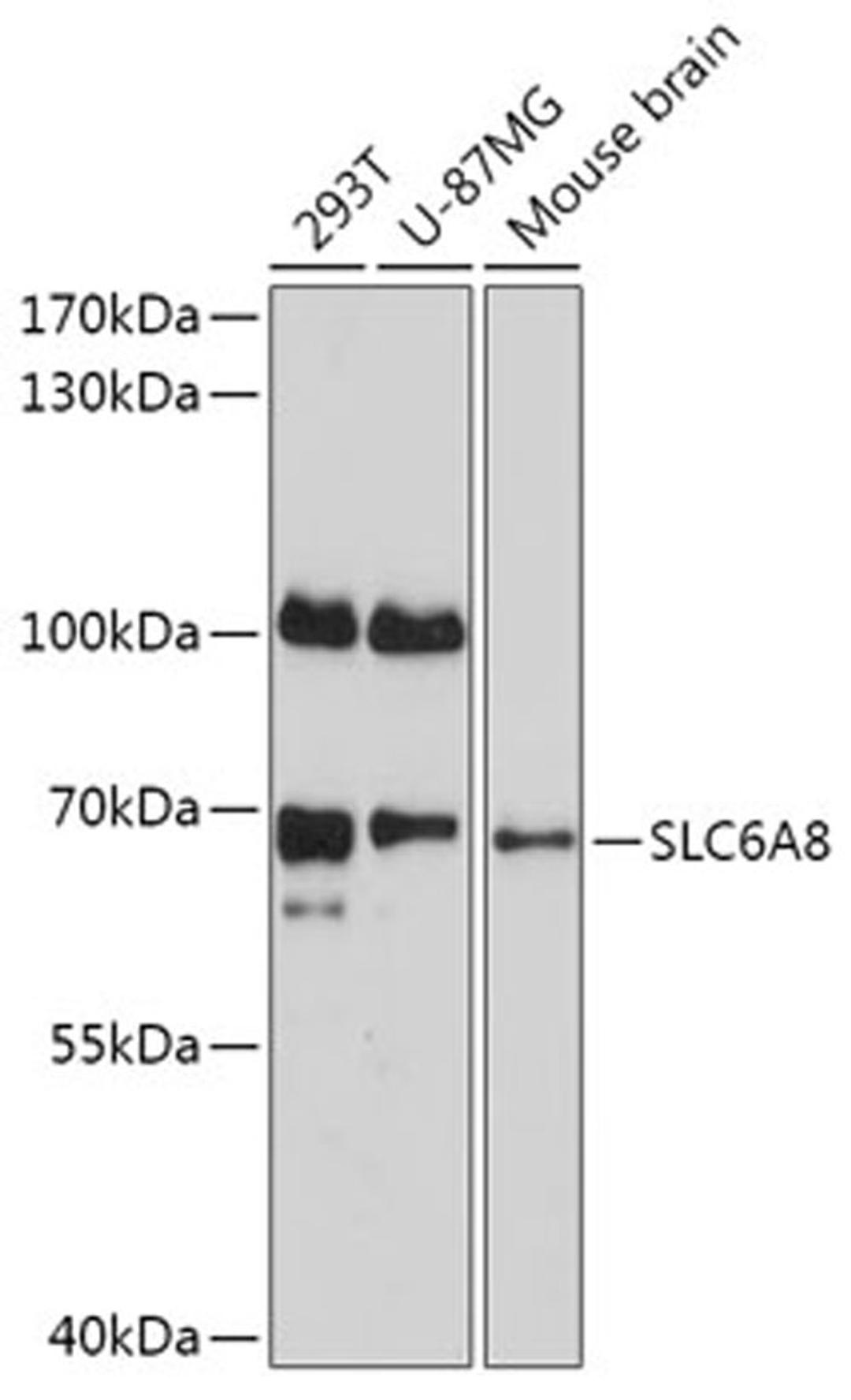 Western blot - SLC6A8 antibody (A17531)