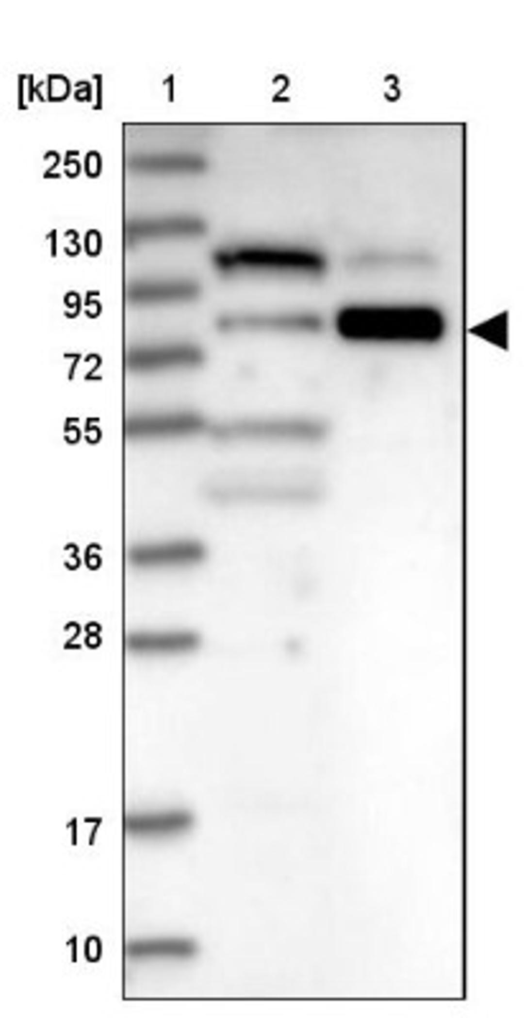 Western Blot: WHAMM Antibody [NBP1-89592] - Lane 1: Marker [kDa] 250, 130, 95, 72, 55, 36, 28, 17, 10<br/>Lane 2: Human cell line RT-4<br/>Lane 3: Human cell line U-251MG sp