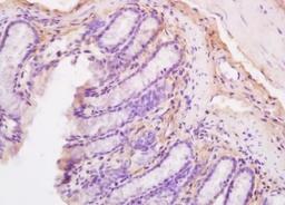 Immunohistochemical analysis of formalin-fixed paraffin embedded mouse intestine tissue using Nitrotyrosine antibody (dilution at 1:200)