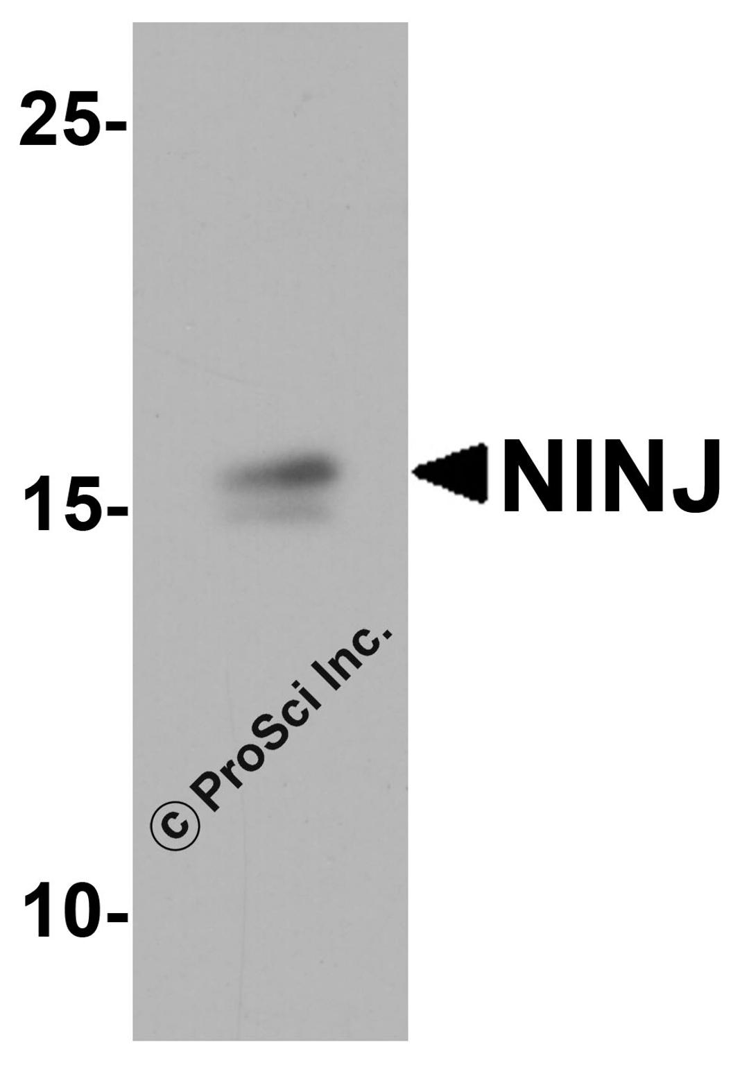Western blot analysis of NINJ1 in human brain tissue lysate with NINJ1 antibody at 1 μg/ml.