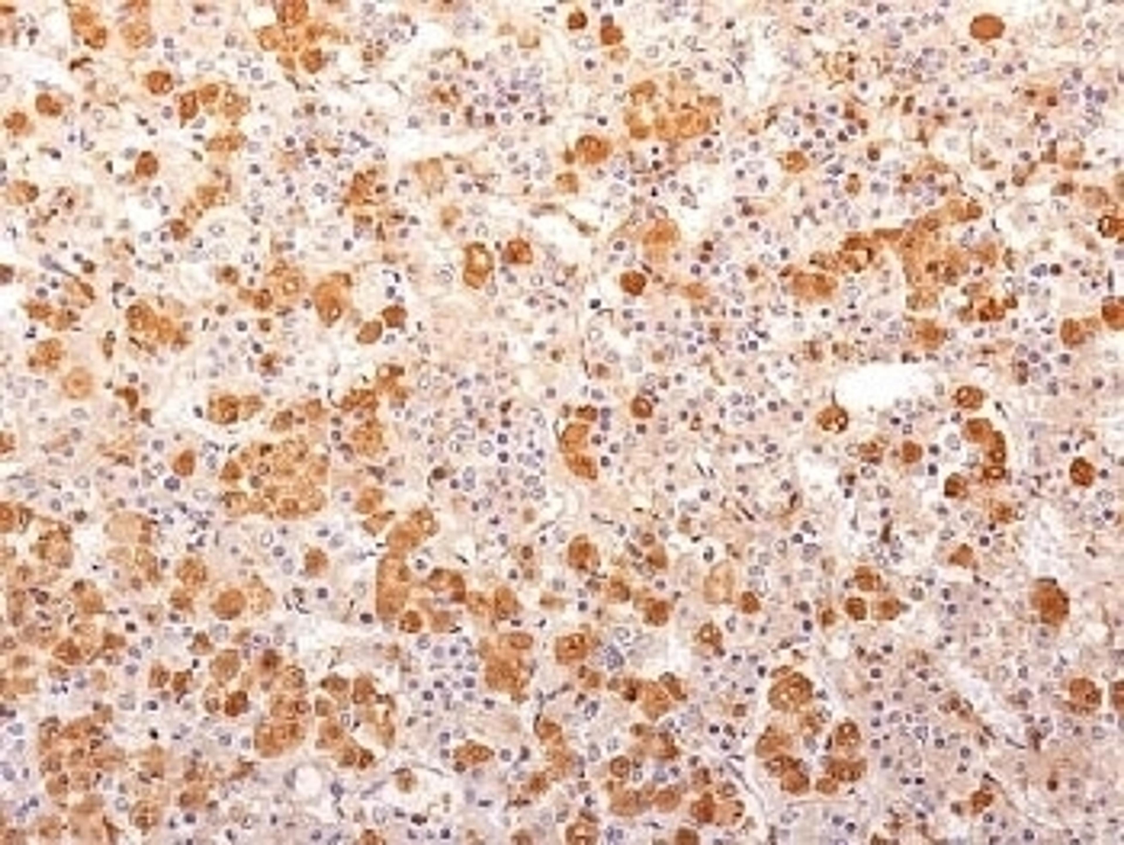 Formalin-fixed, paraffin-embedded human pituitary gland stained with POMC antibody (57).