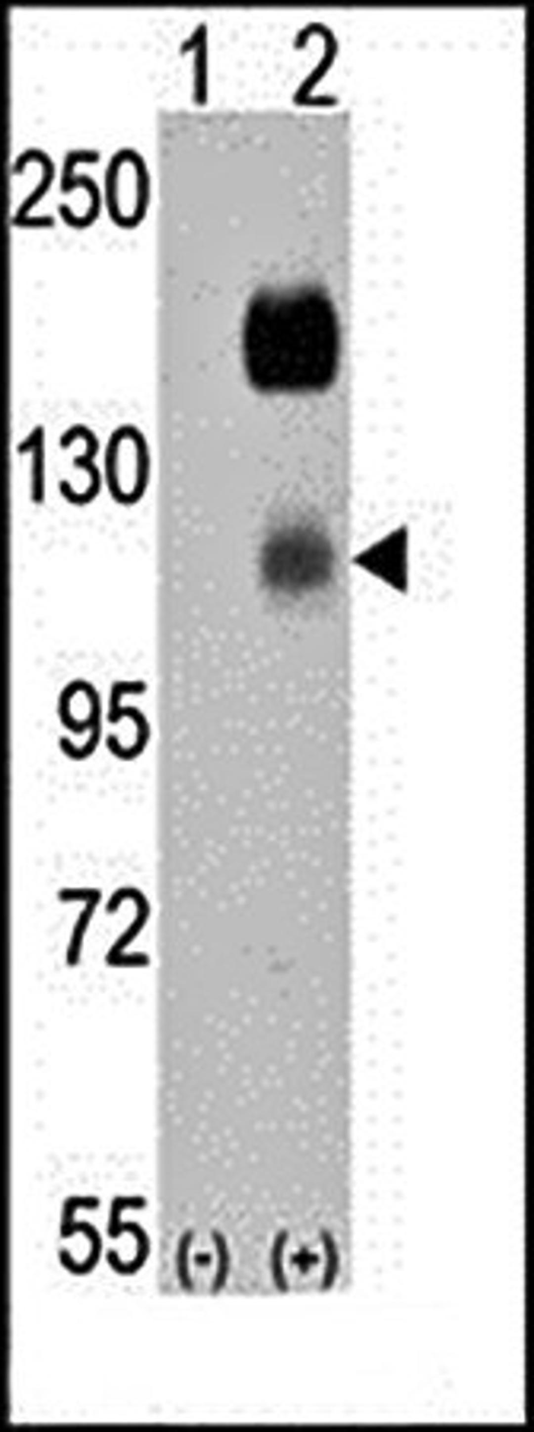 Western blot analysis of CCK4 antibody in 293 cell lysates