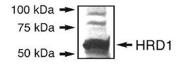 Western Blot: HRD1 Antibody [NB100-2526] - Detection of HRD1 in an endogenous 293T cell lysate.