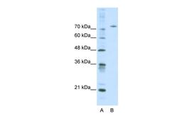 Antibody used in WB on Human HepG2 at 0.2-1 ug/ml.