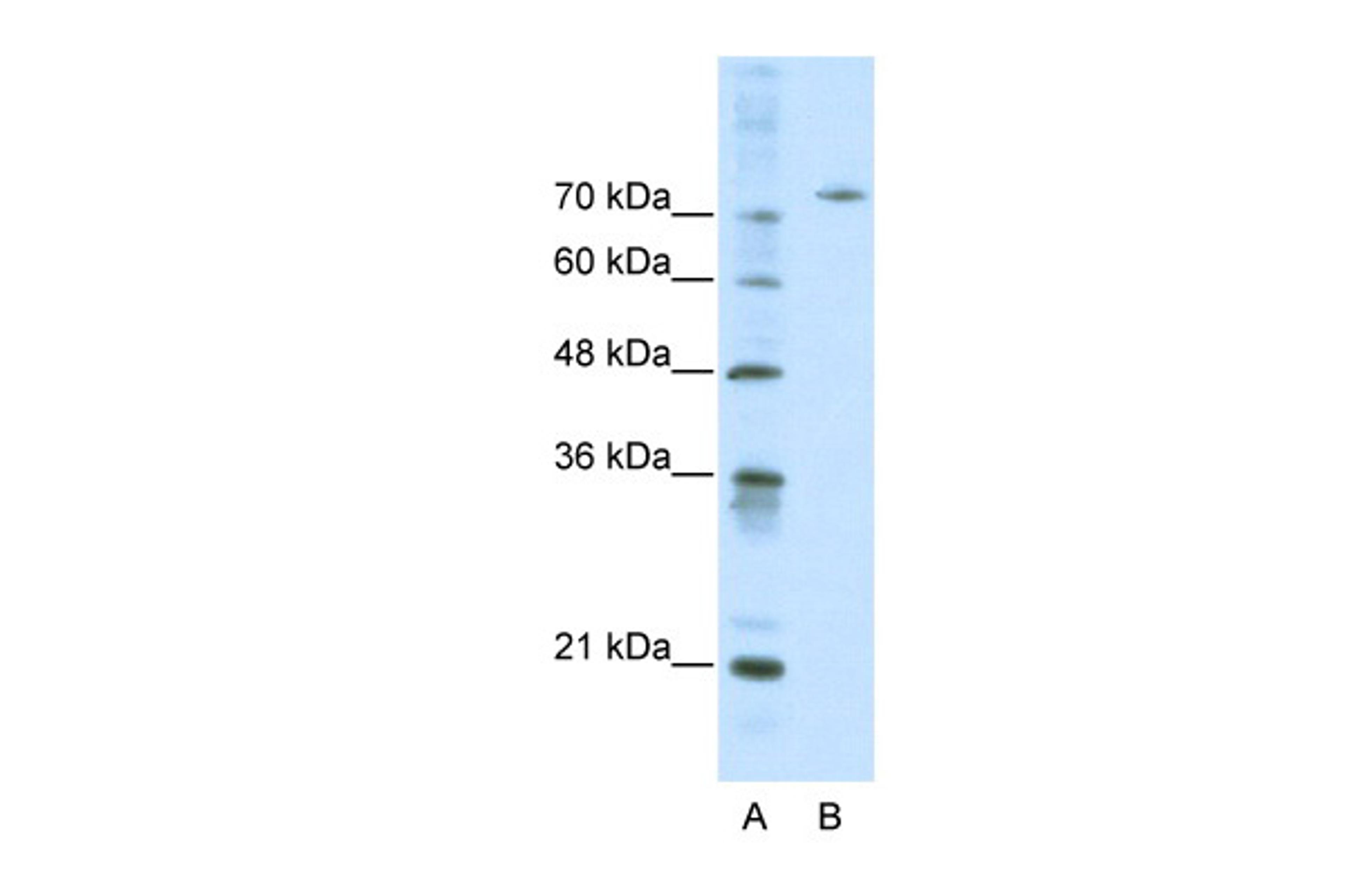 Antibody used in WB on Human HepG2 at 0.2-1 ug/ml.