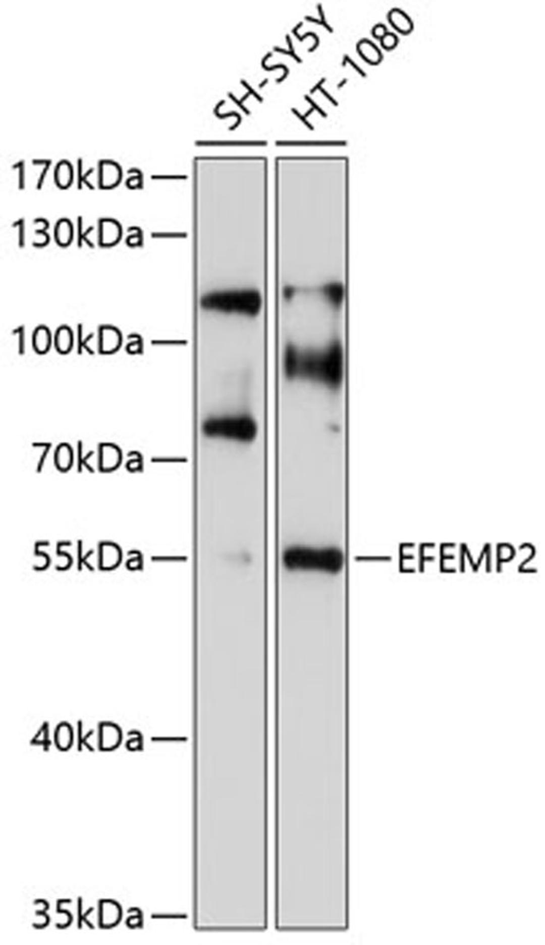 Western blot - EFEMP2 antibody (A10018)