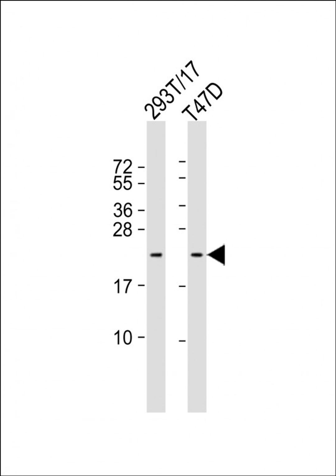 Western Blot at 1:1000 dilution Lane 1: 293T/17 whole cell lysate Lane 2: T47D whole cell lysate Lysates/proteins at 20 ug per lane.