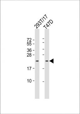 Western Blot at 1:1000 dilution Lane 1: 293T/17 whole cell lysate Lane 2: T47D whole cell lysate Lysates/proteins at 20 ug per lane.