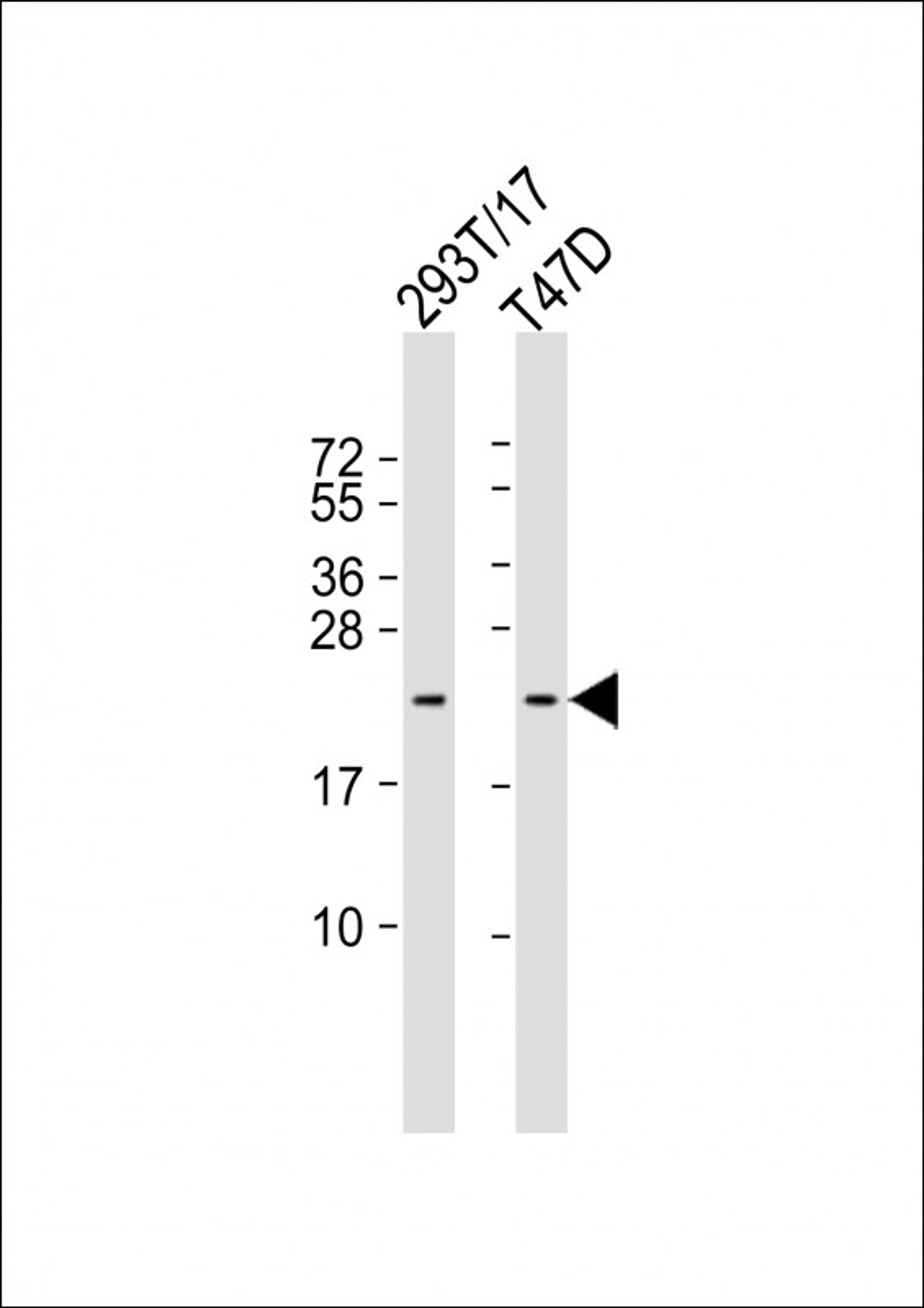 Western Blot at 1:1000 dilution Lane 1: 293T/17 whole cell lysate Lane 2: T47D whole cell lysate Lysates/proteins at 20 ug per lane.