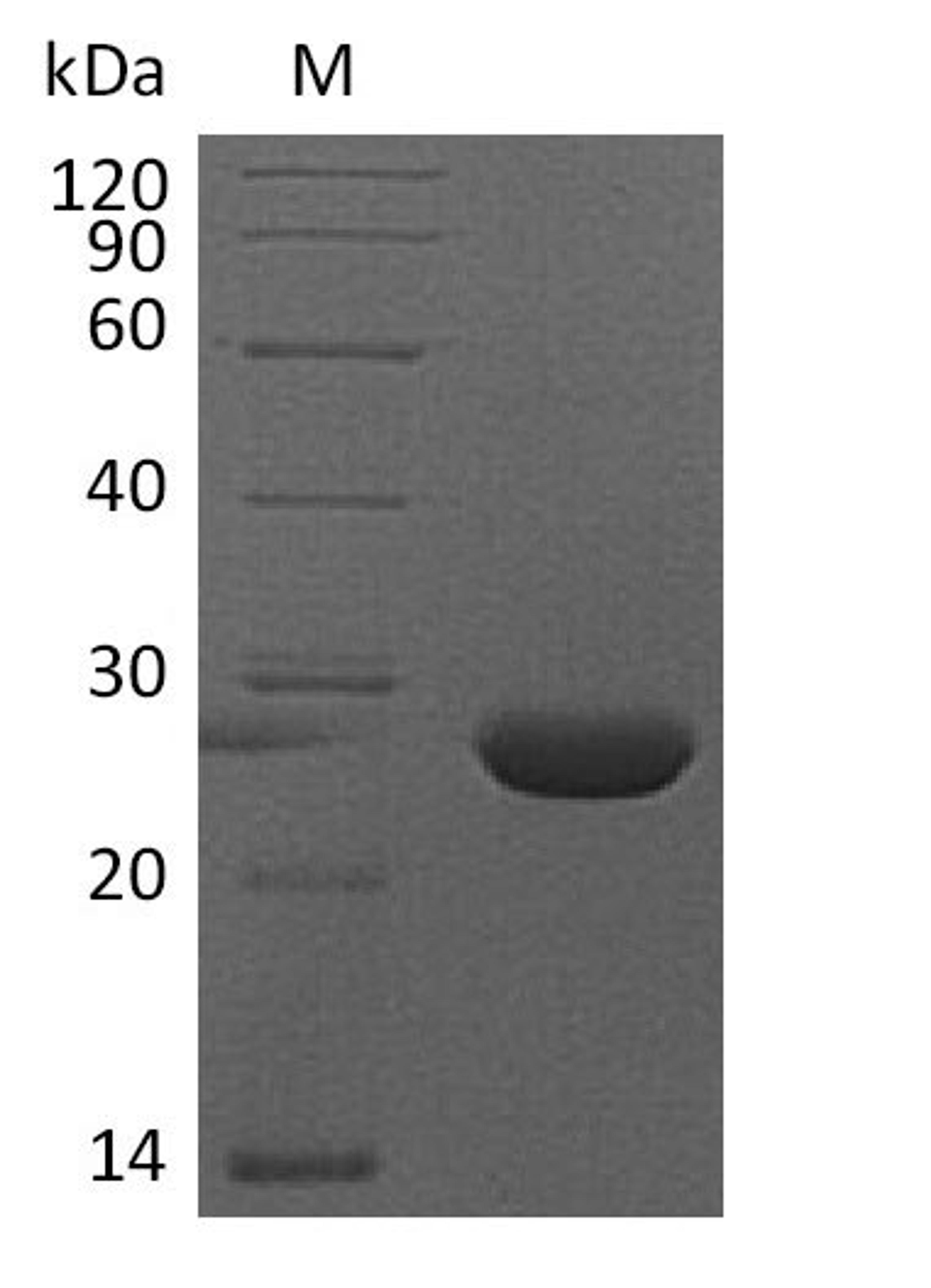 (Tris-Glycine gel) Discontinuous SDS-PAGE (reduced) with 5% enrichment gel and 15% separation gel.
