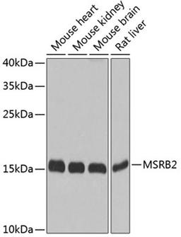 Western blot - MSRB2 antibody (A8364)