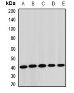 Western blot analysis of Jurkat (Lane1), HepG2 (Lane2), mouse liver (Lane3), rat lung (Lane4), rat brain (Lane5) whole cell lysates using STK19 antibody