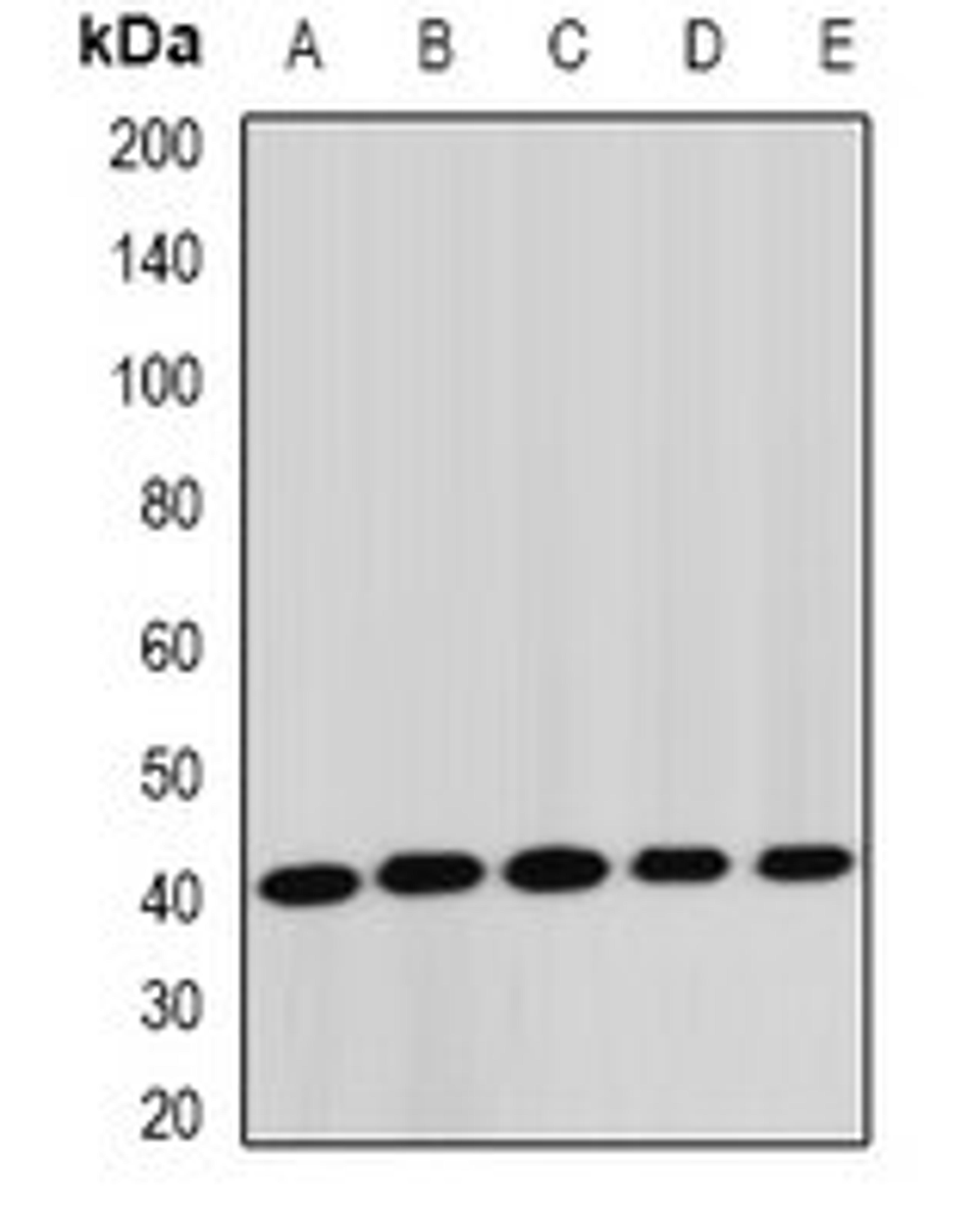 Western blot analysis of Jurkat (Lane1), HepG2 (Lane2), mouse liver (Lane3), rat lung (Lane4), rat brain (Lane5) whole cell lysates using STK19 antibody