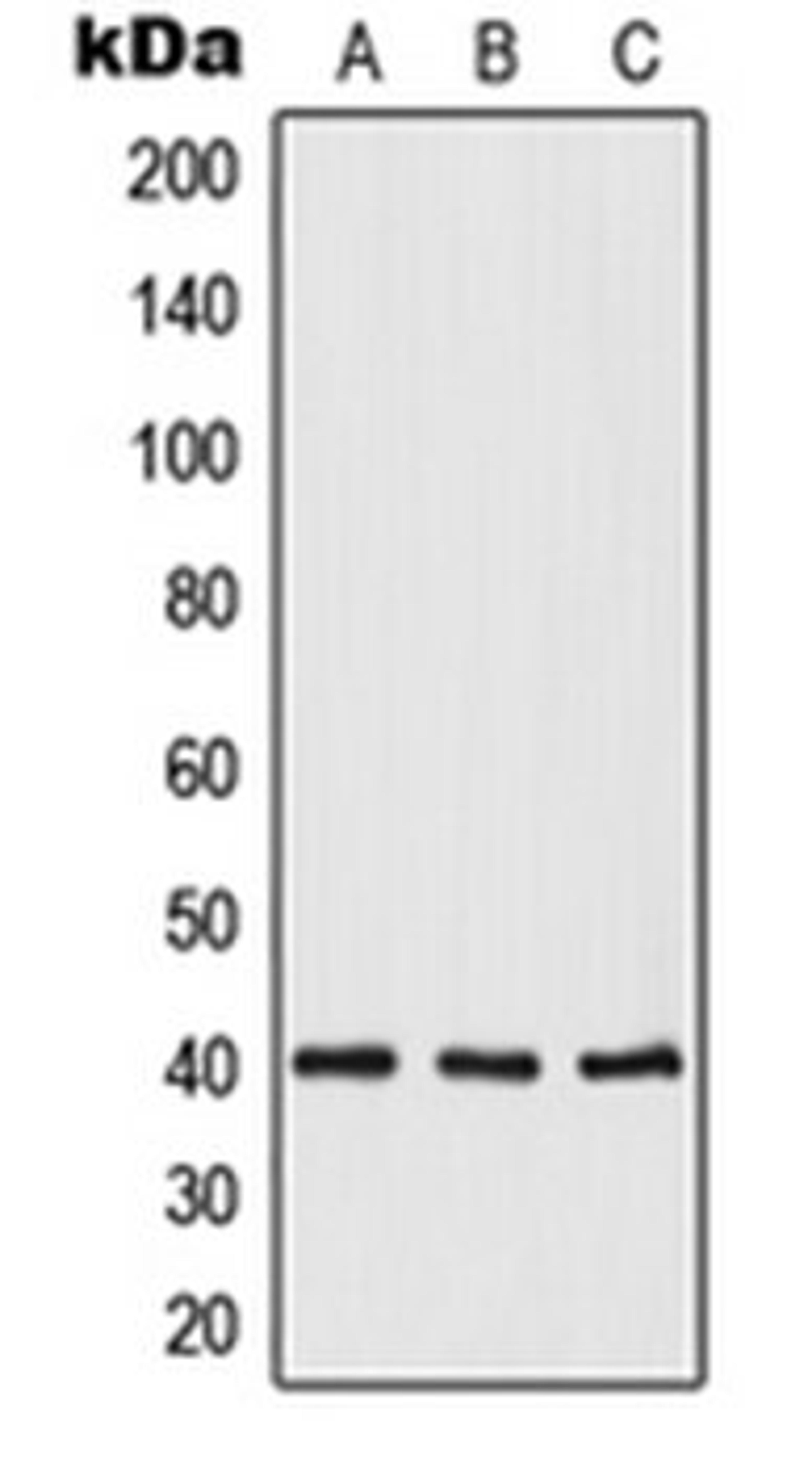 Western blot analysis of HeLa (Lane 1), mouse heart (Lane 2), rat heart (Lane 3) whole cell lysates using OPTC antibody