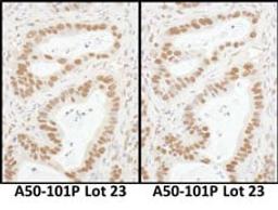 Detection of human Sp1 by immunohistochemistry.