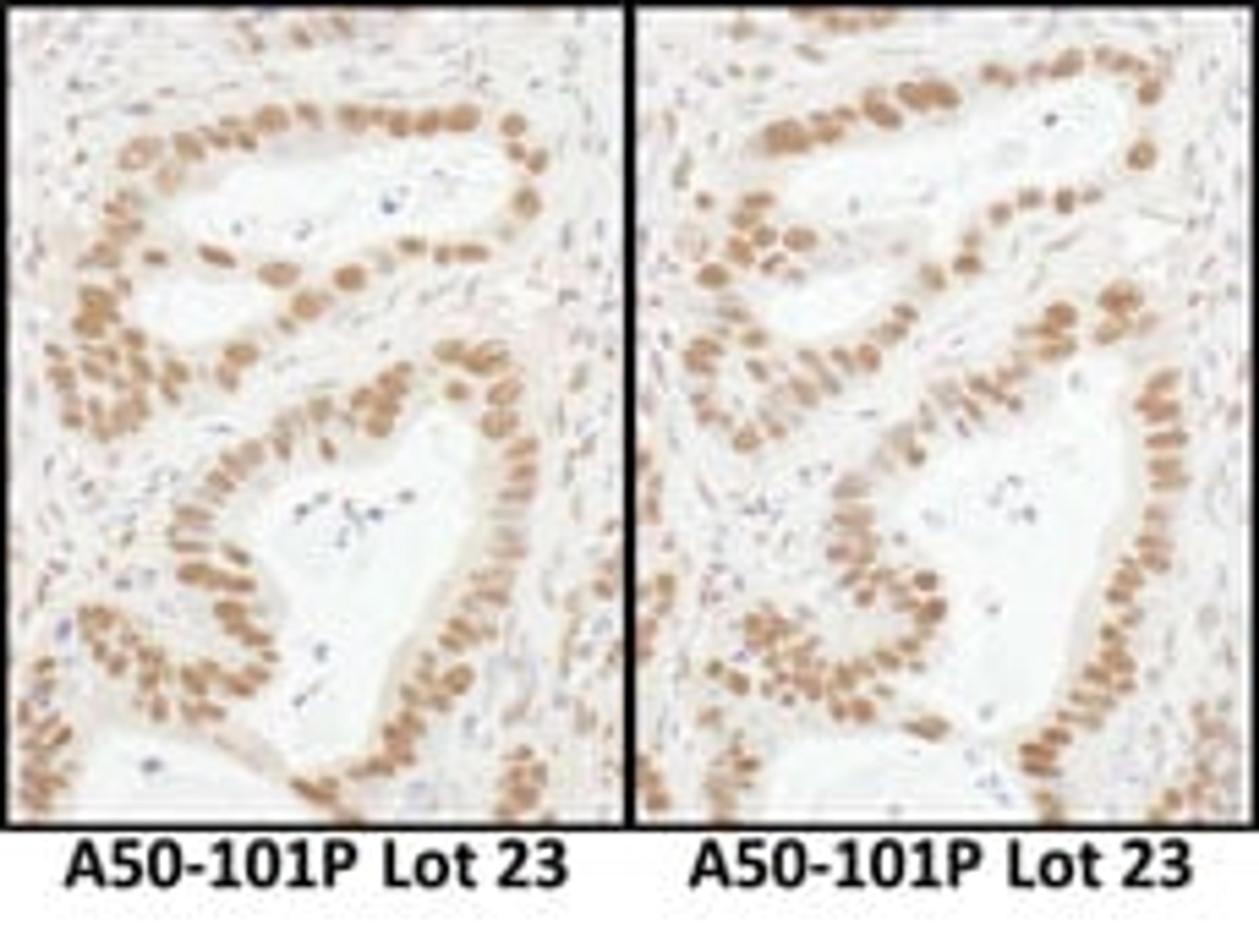 Detection of human Sp1 by immunohistochemistry.