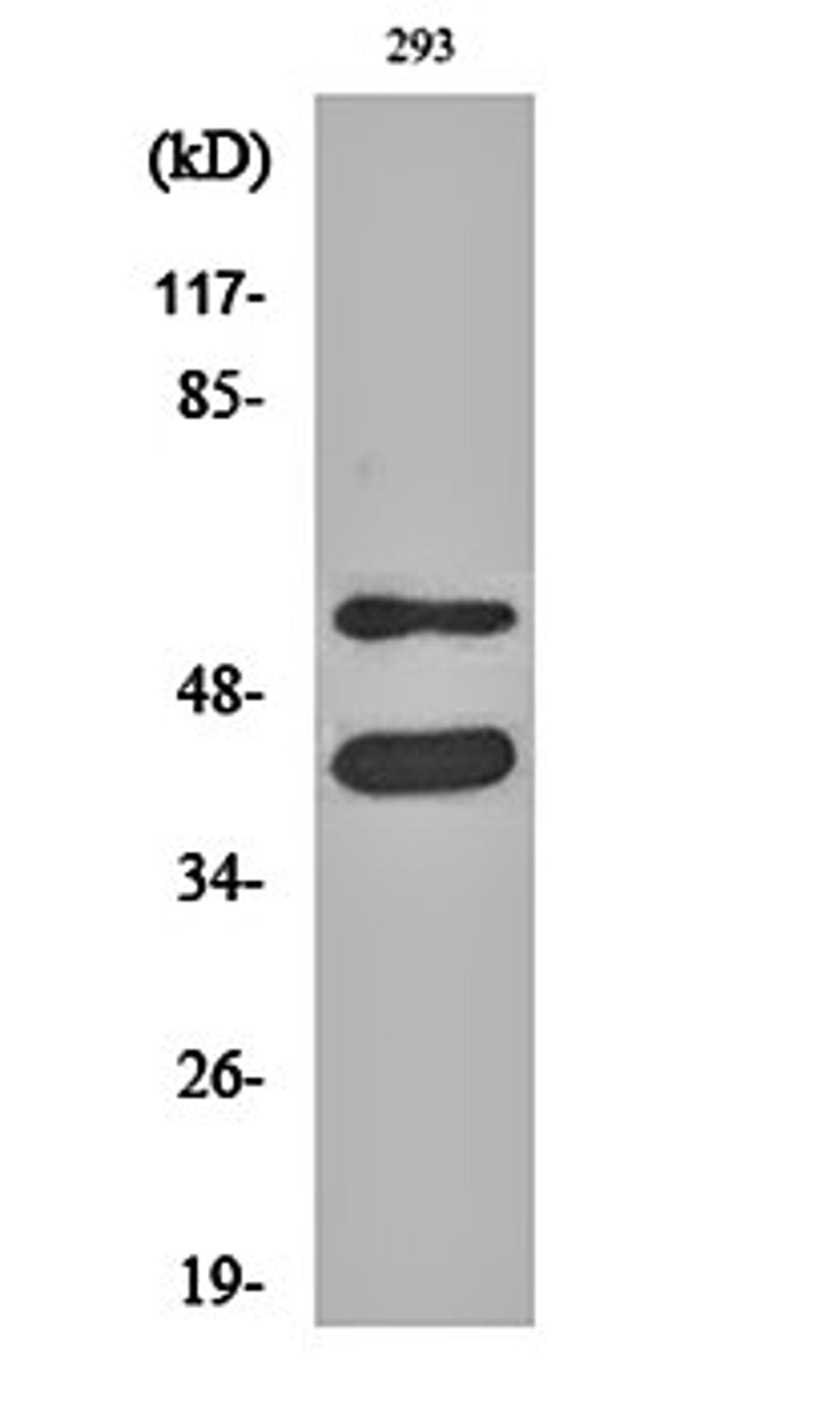 Western blot analysis of 293 cell lysates using GSK3 alpha/beta antibody