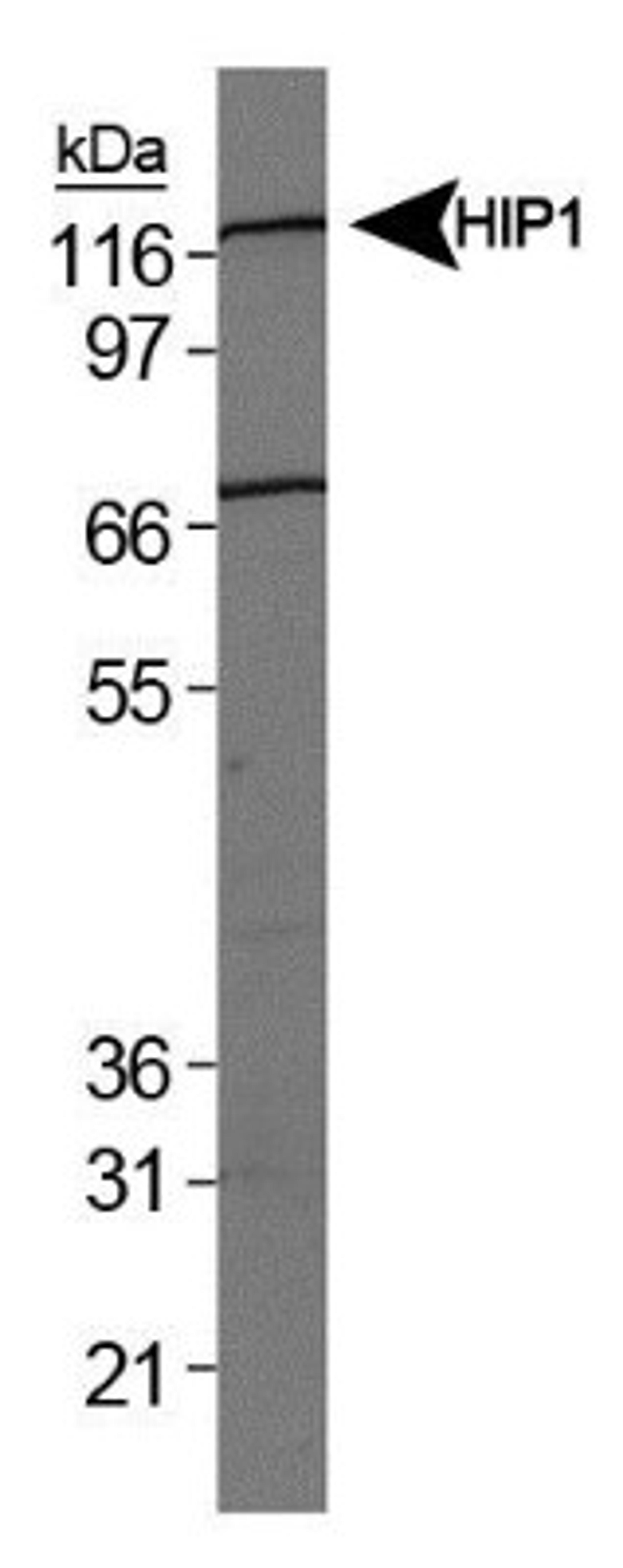 Western Blot: HIP1 Related Antibody (1E1) [NB300-206] - Analysis of HIP1 on HeLa whole cell extract.