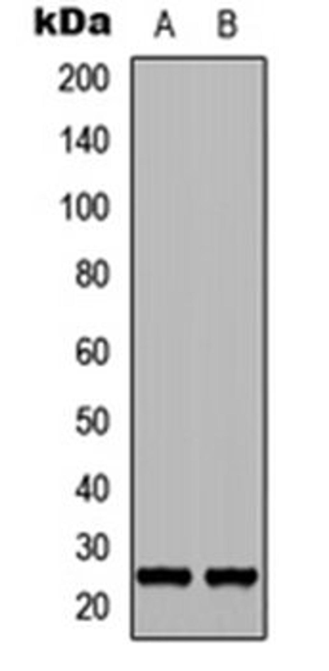 Western blot analysis of NS-1 (Lane 1), PC12 (Lane 2) whole cell lysates using FGF17 antibody