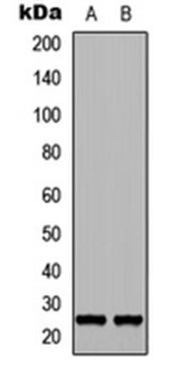 Western blot analysis of NS-1 (Lane 1), PC12 (Lane 2) whole cell lysates using FGF17 antibody