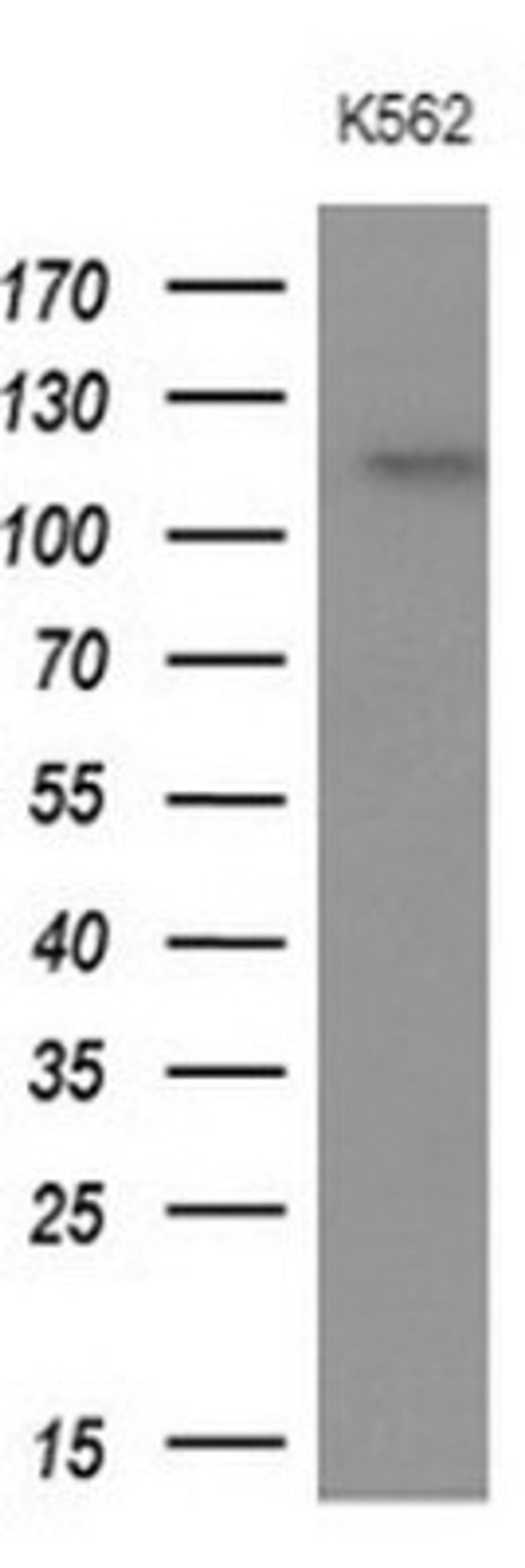 Western Blot: APOB48R Antibody (1B1) [NBP2-46532] - Analysis of extracts (10ug) from K562 cell line.