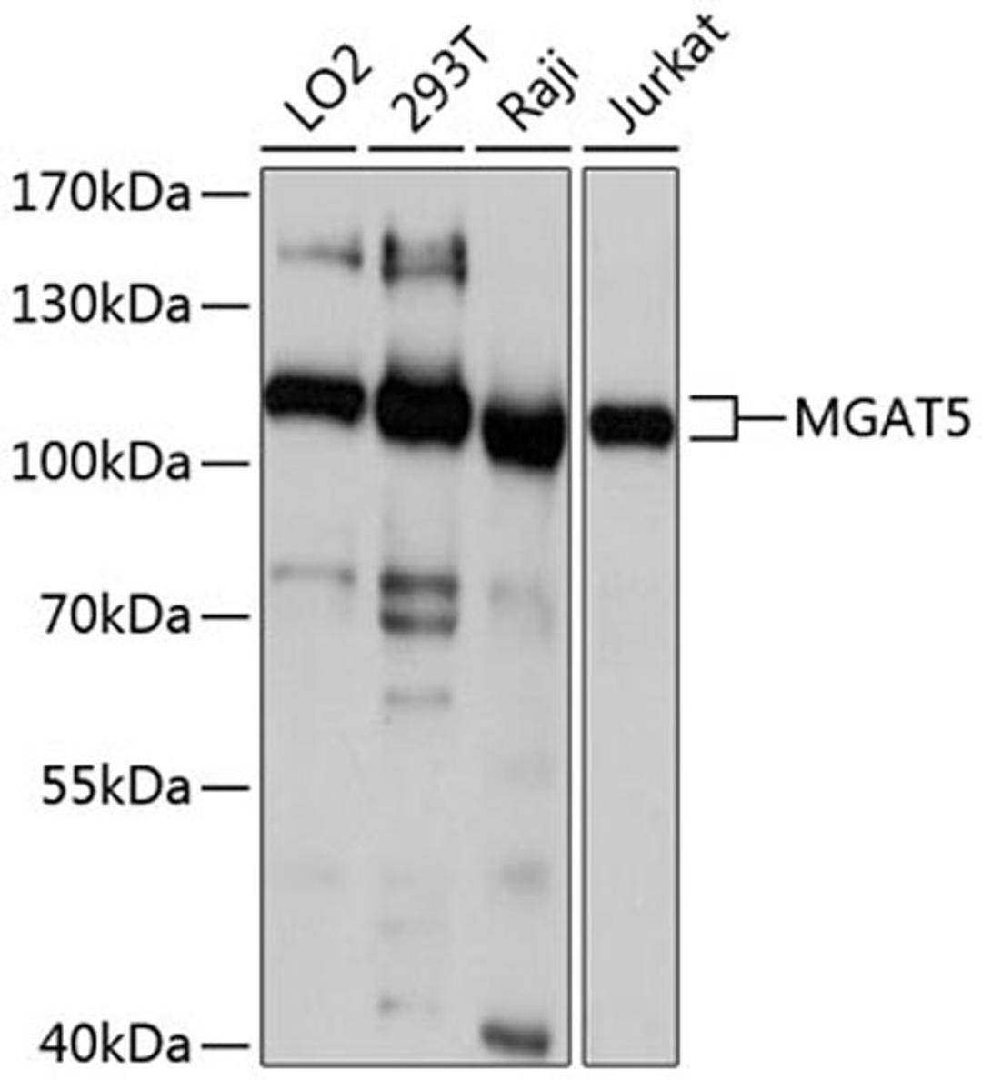 Western blot - MGAT5 antibody (A10567)