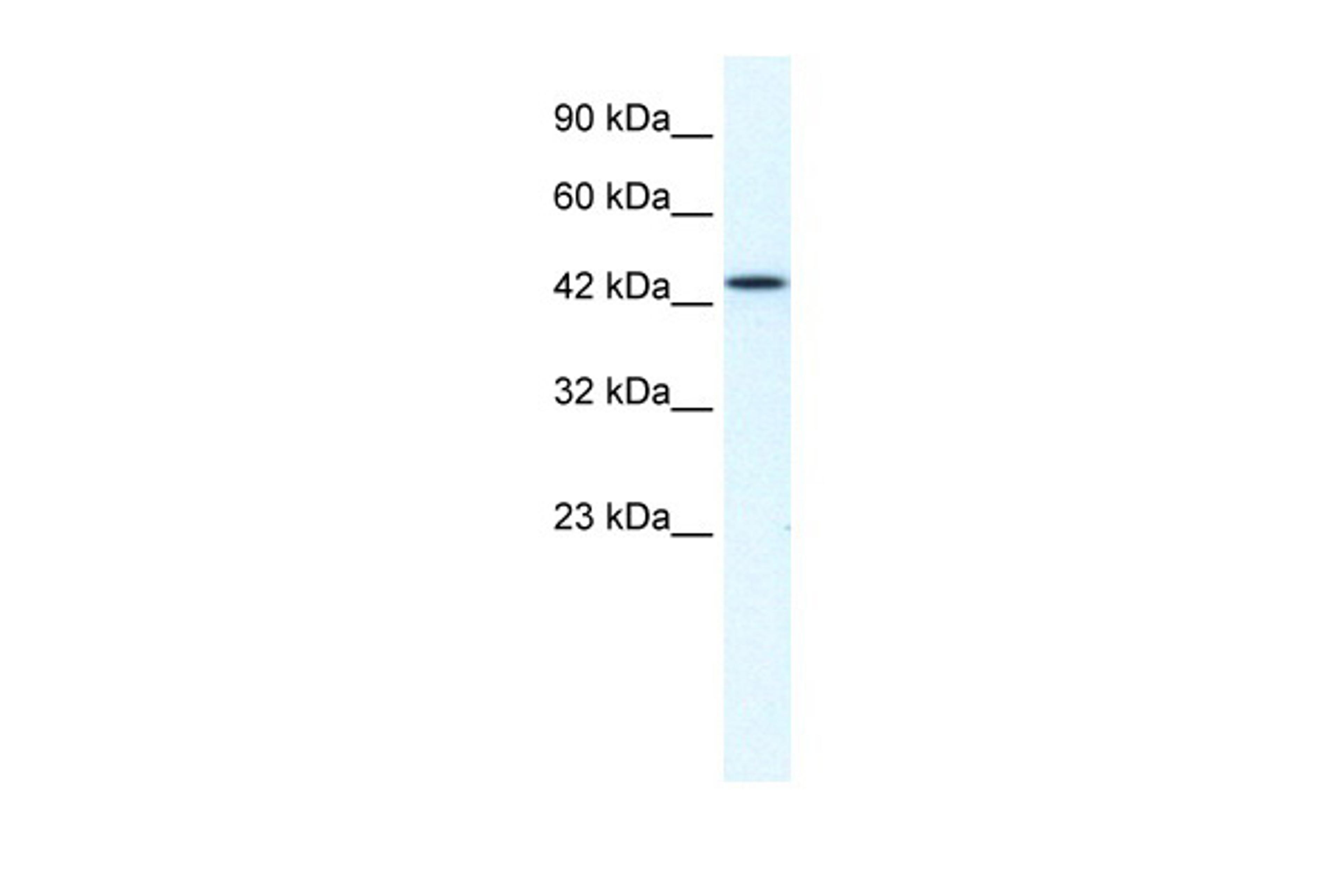 Antibody used in WB on Human HepG2 at 1.25 ug/ml.