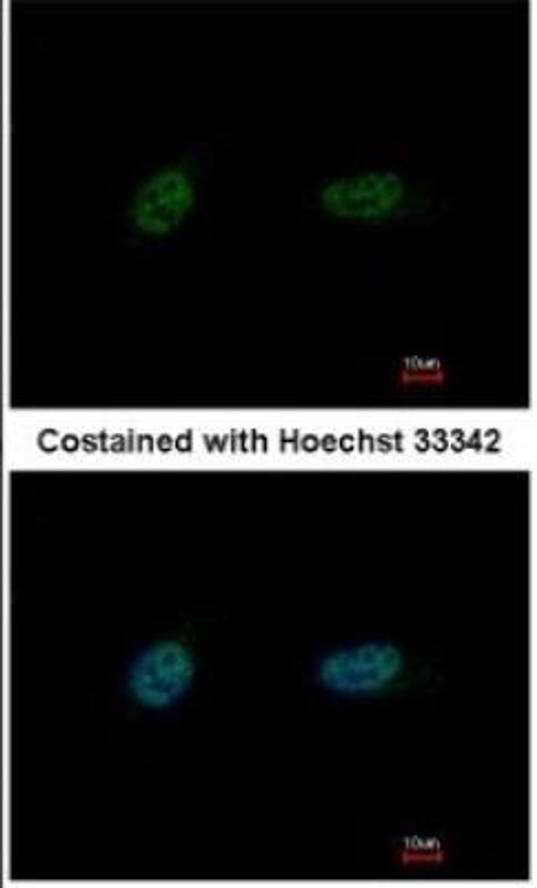 Immunocytochemistry: PARP3 Antibody [NBP1-31415] - Paraformaldehyde-fixed HeLa, using antibody at 1:500 dilution.