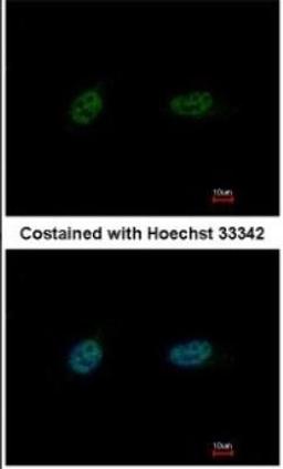 Immunocytochemistry: PARP3 Antibody [NBP1-31415] - Paraformaldehyde-fixed HeLa, using antibody at 1:500 dilution.