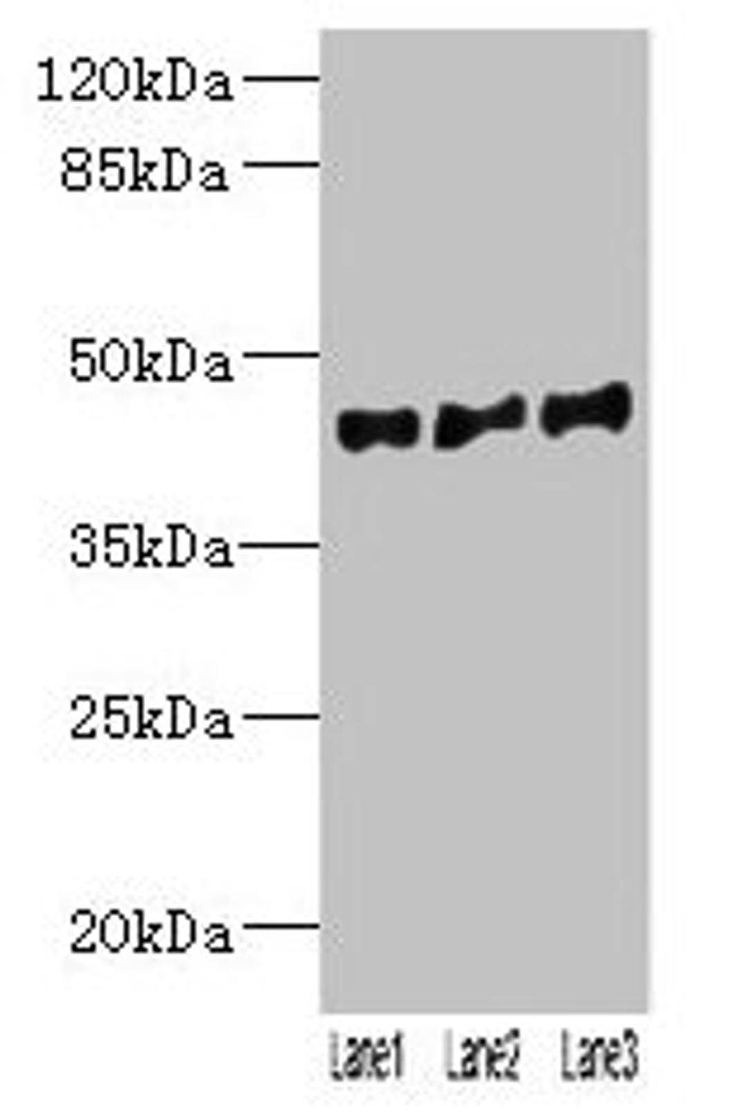 Western blot. All lanes: VN1R2 antibody at 2µg/ml. Lane 1: Hela whole cell lysate. Lane 2: A549 whole cell lysate. Lane 3: HepG2 whole cell lysate. Secondary. Goat polyclonal to rabbit IgG at 1/10000 dilution. Predicted band size: 45 kDa. Observed band size: 45 kDa