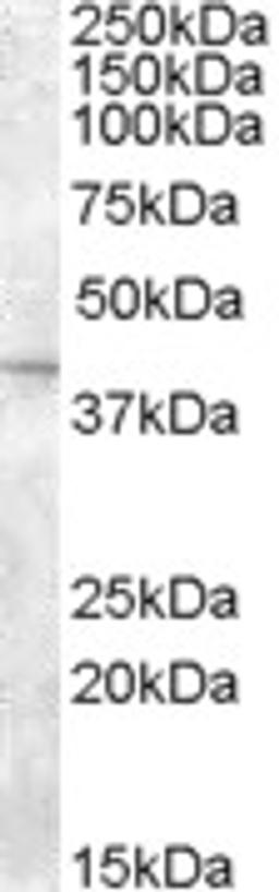 46-376 (2ug/ml) staining of Mouse Eye lysate (35ug protein in RIPA buffer). Primary incubation was 1 hour. Detected by chemiluminescence.