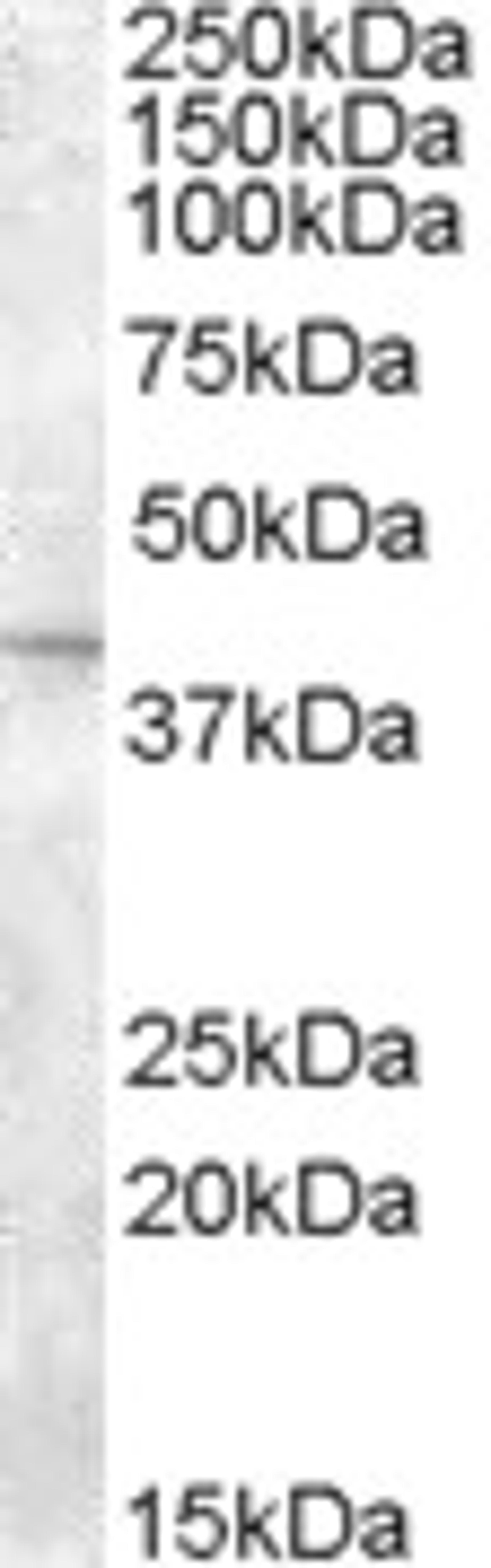 46-376 (2ug/ml) staining of Mouse Eye lysate (35ug protein in RIPA buffer). Primary incubation was 1 hour. Detected by chemiluminescence.