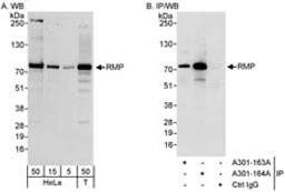 Detection of human RMP by western blot and immunoprecipitation.