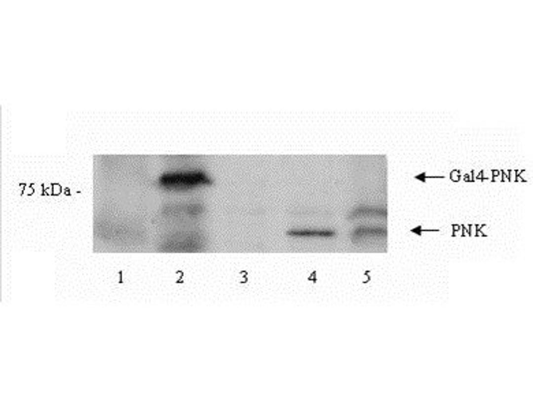 Western blot analysis of Y190 yeast cell lysate using PNK antibody