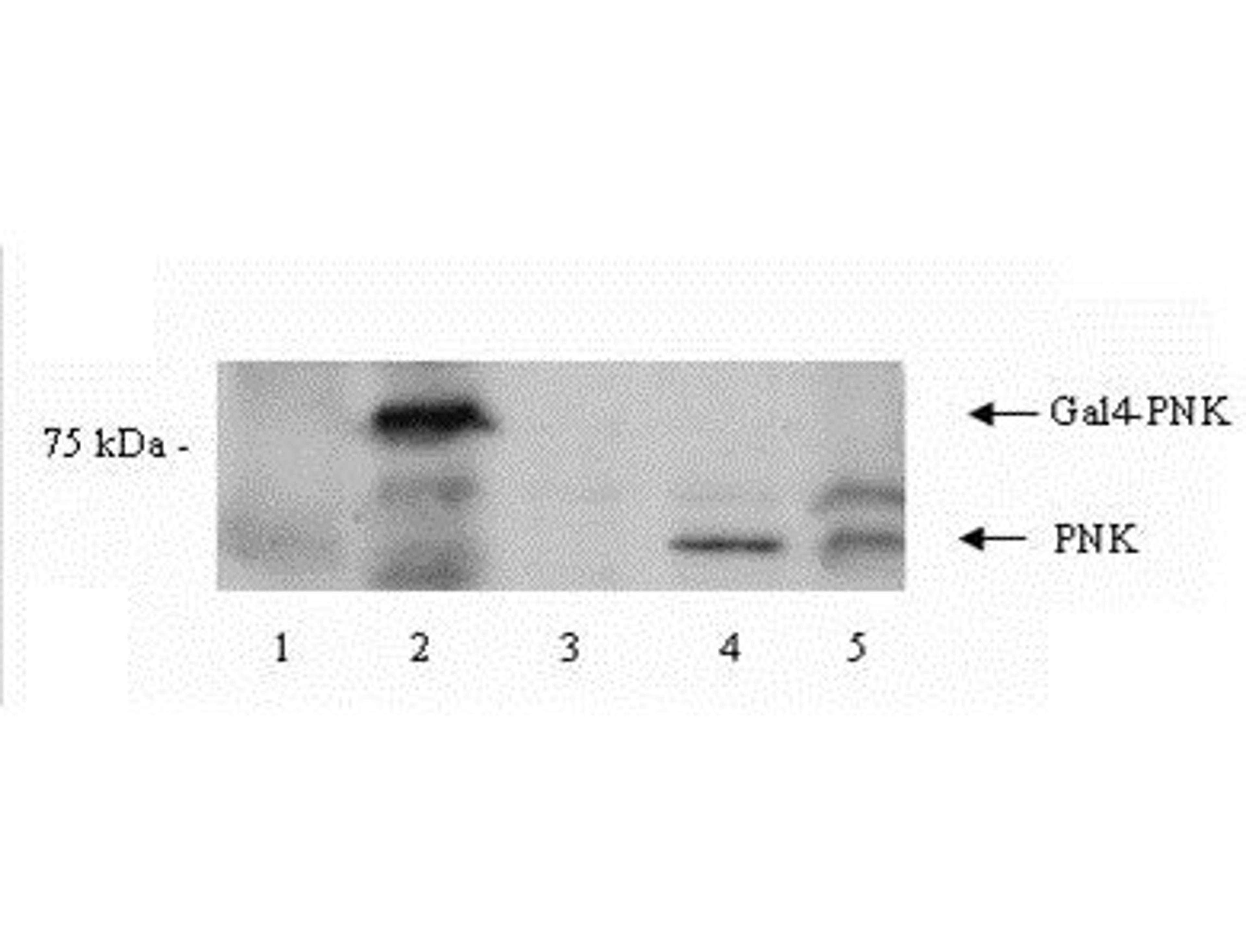 Western blot analysis of Y190 yeast cell lysate using PNK antibody