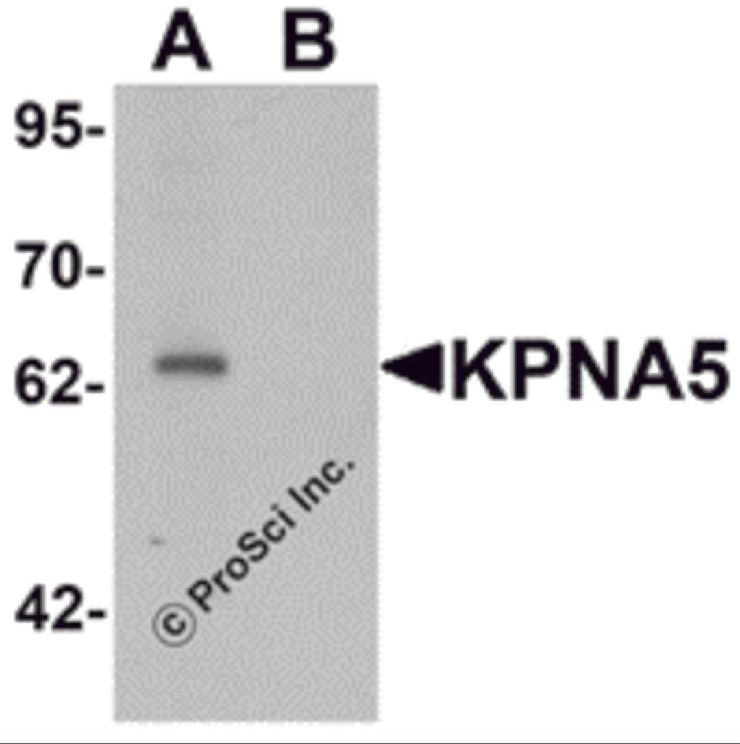 Western blot analysis of KPNA6 in EL4 cell lysate with KPNA5 antibody at 1 μg/mL in (A) the absence and (B) the presence of blocking peptide.