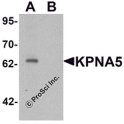 Western blot analysis of KPNA6 in EL4 cell lysate with KPNA5 antibody at 1 μg/mL in (A) the absence and (B) the presence of blocking peptide.